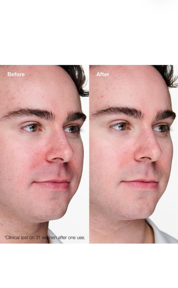 Clinique gel anti imperfezioni 20ml